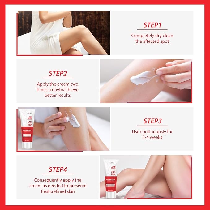 Urea Cream 30 Percent for Feet 3.38 oz, Foot Cream and Hand Cream Maximum Strength with Hyaluronic Acid, Aloe Vera for Deep Moisturizes, Callus Remover