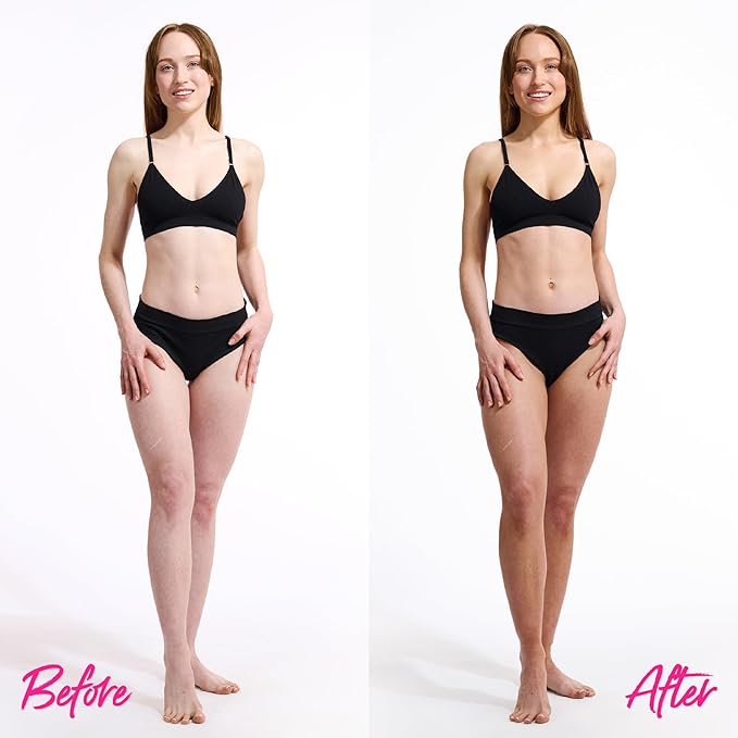 Skinny Tan Self-Tanning Mousse - Long-Lasting and Non-Drying Formula - Coconut and Vanilla Scent - Easy To Apply Luxurious, Foam Texture - Streak Free and Natural Looking Results - Medium - 5 oz