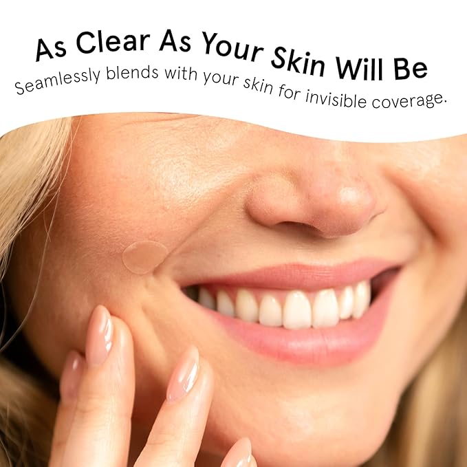 grace & stella Award Winning Multi-Size Pimple Patches for Face - Dermatologist Tested Acne Patches for Face - Hydrocolloid Patch for Breakouts, Whiteheads - Vegan Pimple Patch (Clear, 72 Pack)