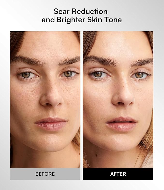 INIA Red Light Therapy Mask for Face, Glow Wireless LED Face Mask Light Therapy with Near-Infrared Red Light (NIR), Rechargeable and Ergonomic Design for Home & Travel