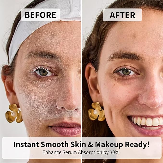 Dermaplane Razor for Women Face, Precision Face Razors for Women, Dermaplaning Tool, Gentle Exfoliation, Perfectly Shape Brows, Reusable Metal Handle with 8 Microblades,Gray