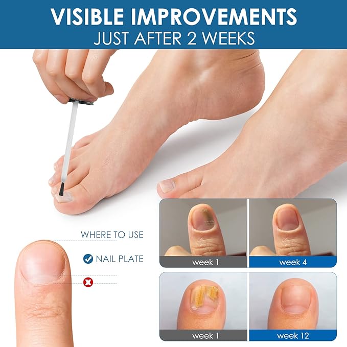 Toenail Repair Treatment, Extra Strength