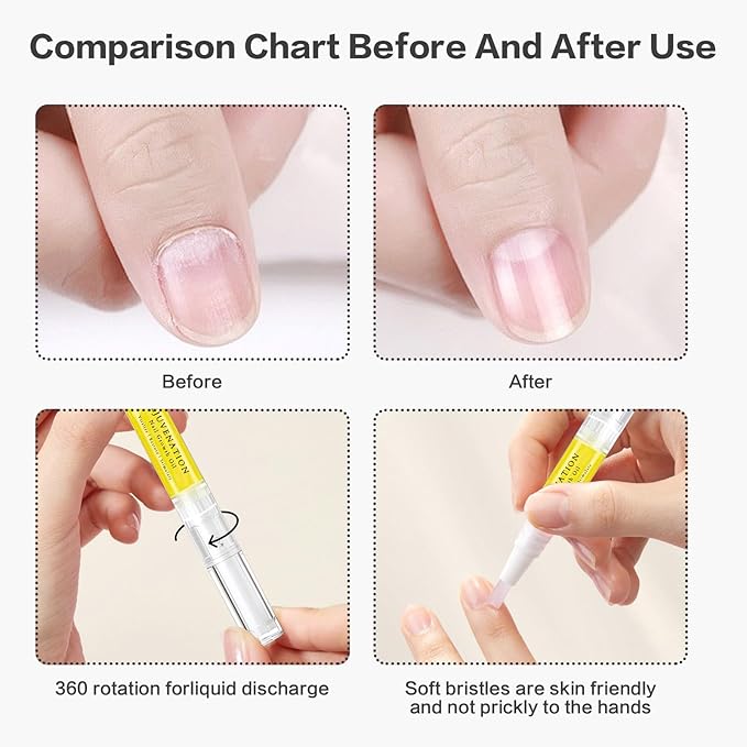 Radiant Nail Growth Oil, Nail