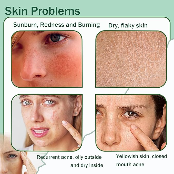 Moisturizing Gel for Face & Body,Non-sticky Gel After Sun Aloe Lotion Skin Care,Fast Absorbing Long Lasting Refreshing Hydrating Face Moisturizer for All Skin Types 04