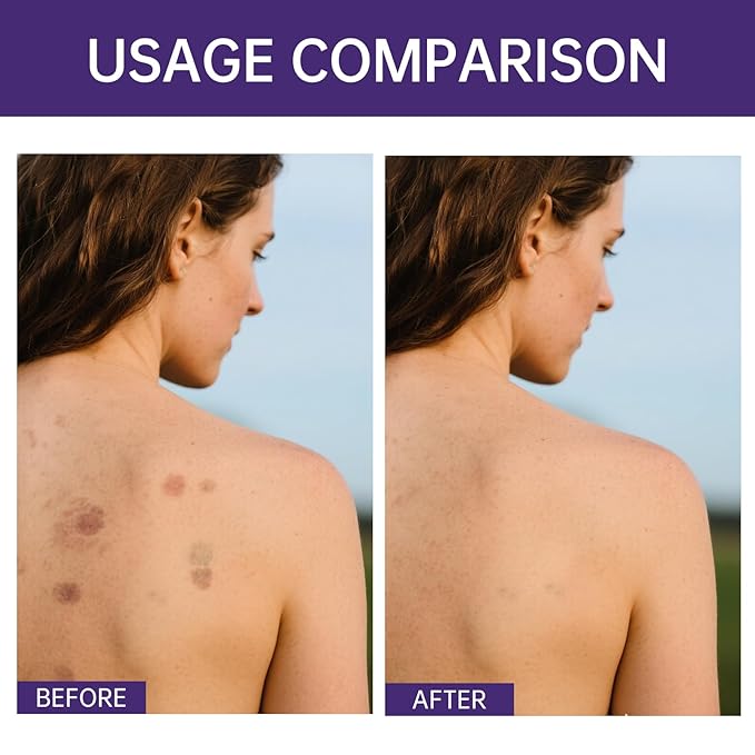 Body Coverage Perfector with Brush - Waterproof Leg & Body Makeup for Skin Imperfections & Uneven Tone, Transfer-Resistant Natural Finish Concealer, Flawless Looking Legs (Natural Radiance)