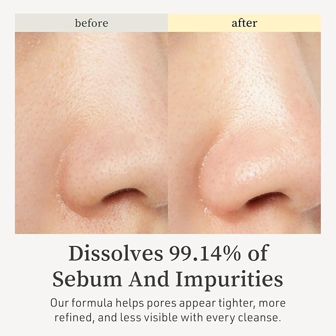 NOONI Facial Cleanser - Snow Aqua 0 LHA Toning Cleansing Oil | Makeup Blackhead Remover, Pore Control, Glass Skin, Help Control Sebum, Revitalizing, Moisturizing, Korean Skin Care, 6.76 Fl Oz (200 ml)