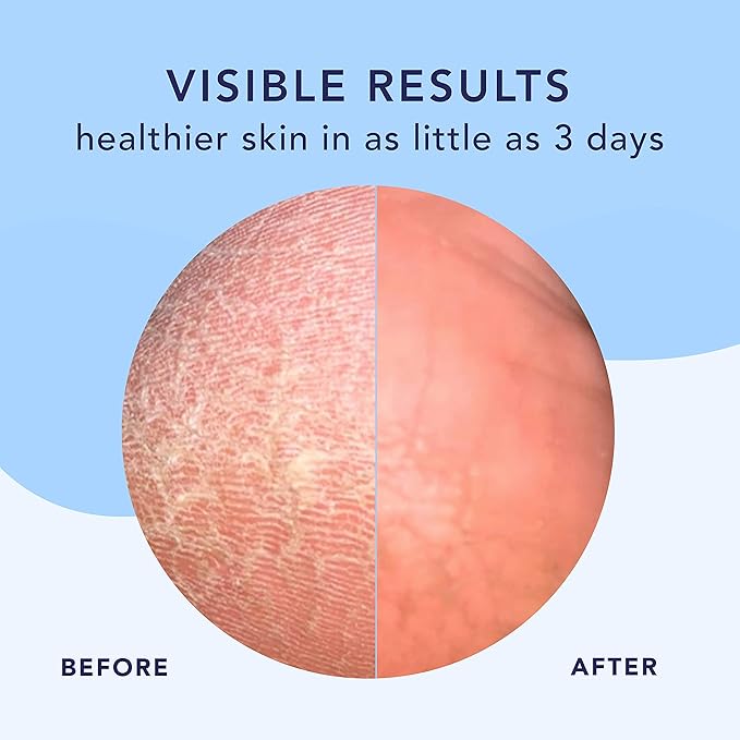 Barefoot Scientist High Dive Intensive Hydration Foot Therapy Cream, Specialized Moisture for Dry Feet and Cracked Heels