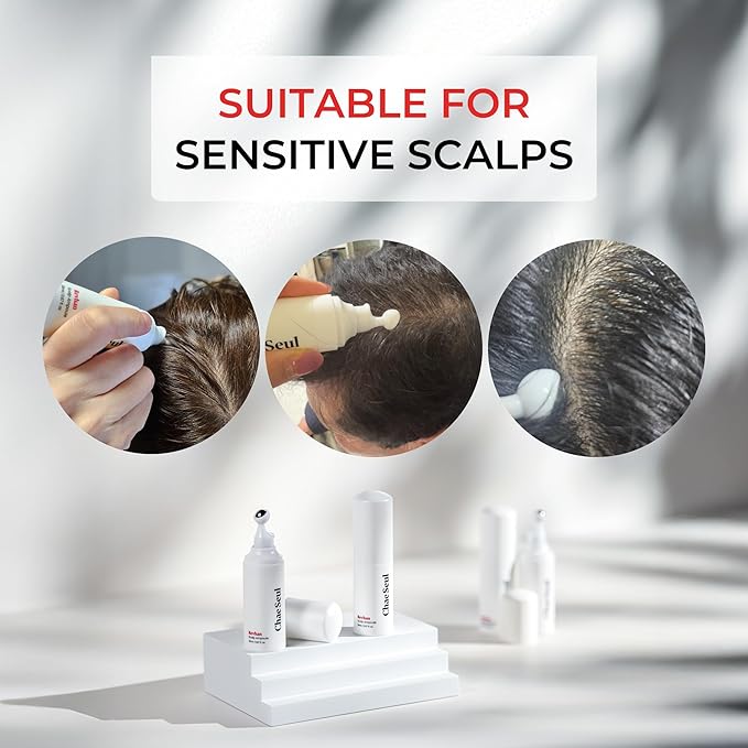Revhan Scalp Serum for Hair Loss & Thinning – Hair Growth Serum for Men & Women w/Salicylic Acid & Centella Asiatica – Soothes Itchy, Irritated Scalp with Roll-On