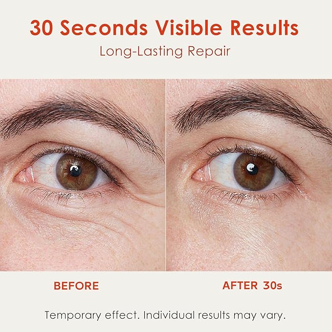 30S Instant Eye Lift Cream | Temporary Eye Tightener | Smooths Wrinkles, Puffy Eyes & Eye Bags | Dual-Action Firming | PDRN Formula for Long-Term Repair, Korean Skincare, 0.71 Fl Oz