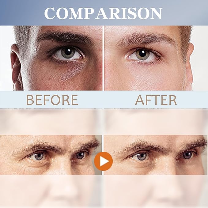 Men's Restoring Eye Cream Under Eye Cream for Dark Circles & Puffiness, Delay Aging Process of Eye Skin, Hydrating & Moisturizing, Reduces Puffiness, and Fine Lines