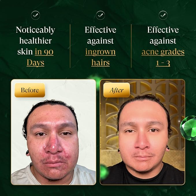 douxds Flex™ Pro Vibrating Face Brush, Electric Face Scrubber, Face Scrubber for Men, Flex™ Face Brush, Men's Skin Care, Powerful Sonic Technology, Removes Dark Marks and Bumps, Acne Treatment