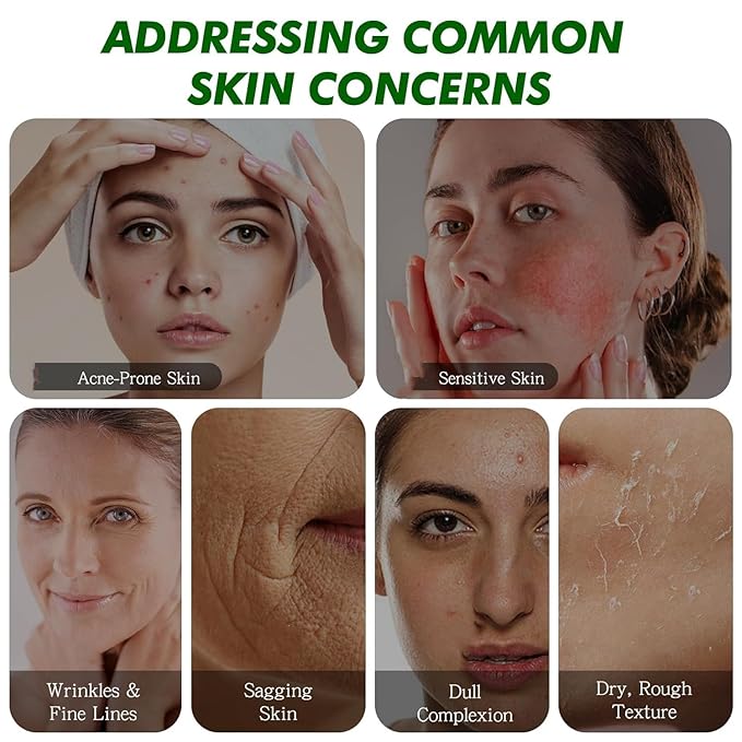 Snail Mucin 92% Repair Cream Face Moisturizer, Body Hydrating for Dry & Sensitive Skin, Snail Gel Essence Daily Serum for All Skin Women Men