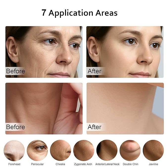 7 in 1 Multifunctional Facial Massager, Red Light Therapy for Face with 7 Modes, Face Lift Device, Portable Facial Massager for Wrinkles,Neck&Skin Care-White