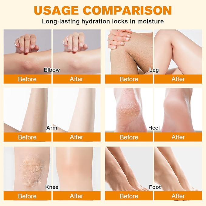 Tallow for Skin, Moisturizer Cream, Nourishing and Hydrating Skin, Organic Tallow & Honey Balm for Skin,Natural Grass-Fed Tallow Cream with Raw Honey for All Skin Care (1 PCS,60g)