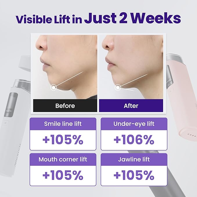 Core Impact – Face Massager for Sagging Skin, Boosts Skincare Absorption, Supports Radiant Glow and Lifting Effect (Midnight Black)