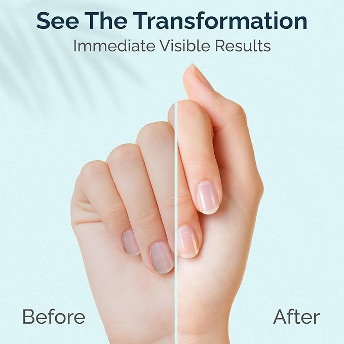 Nourishing Cuticle and Strengthening Nail