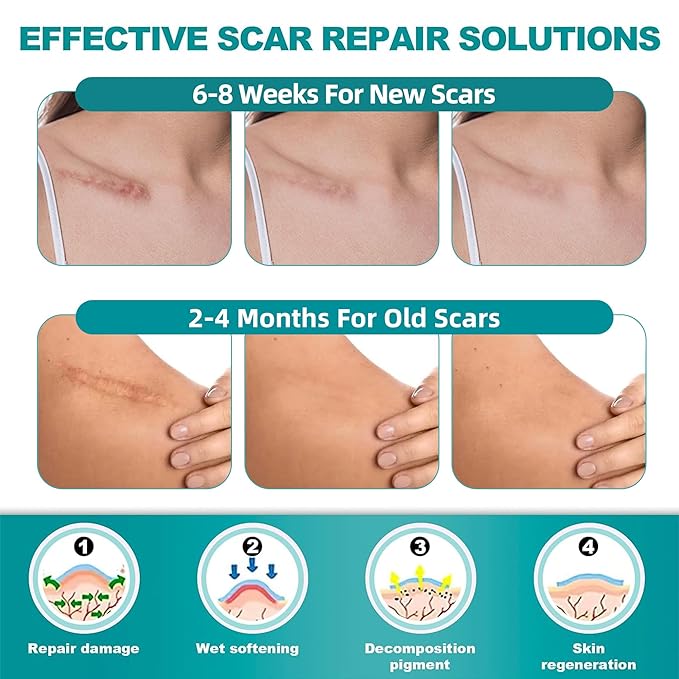 Extra Long Silicone Scar Sheets (1.6”