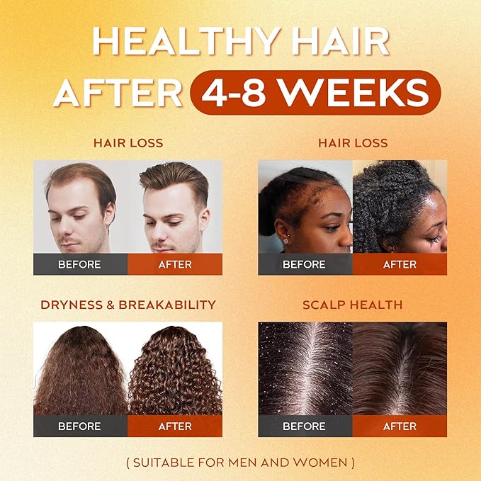 Batana Oil for Hair Growth Dr Sebi, 100% Raw Organic Batana Hair Mask from Honduras, Wild Growth Hair Oil, Scalp Oil Promotes Hair Thickness, Prevents Loss for Men & Women, 4.06 fl oz (1 Pack)