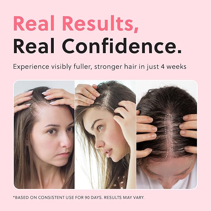 Revolutionary Hair Regrowth Serum - Fights Hair Thinning & Hair Loss - Strengthens, Thickens and Accelerates Hair Growth- Non Greasy and Hormone Free Spray For Scalp- 50ml - Forhair