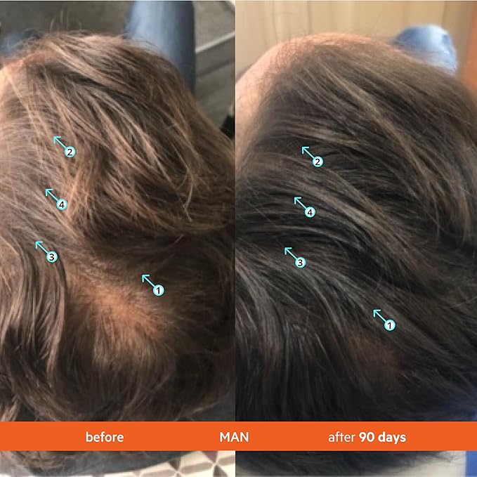 DS Labs Revita Conditioner, 500mL - Lightweight, Scalp First Hydration for Fuller Looking, Softer Hair, Thickening Appearance, Sulfate & Silicone Free, Color Safe, For Men & Women