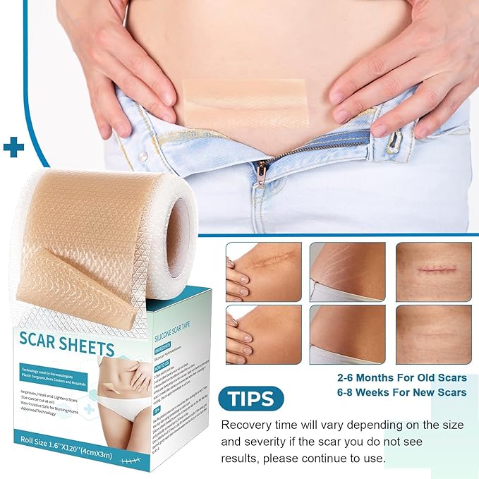Silicone Scar Sheets, Silicone Scar Tape(1.6¡±x