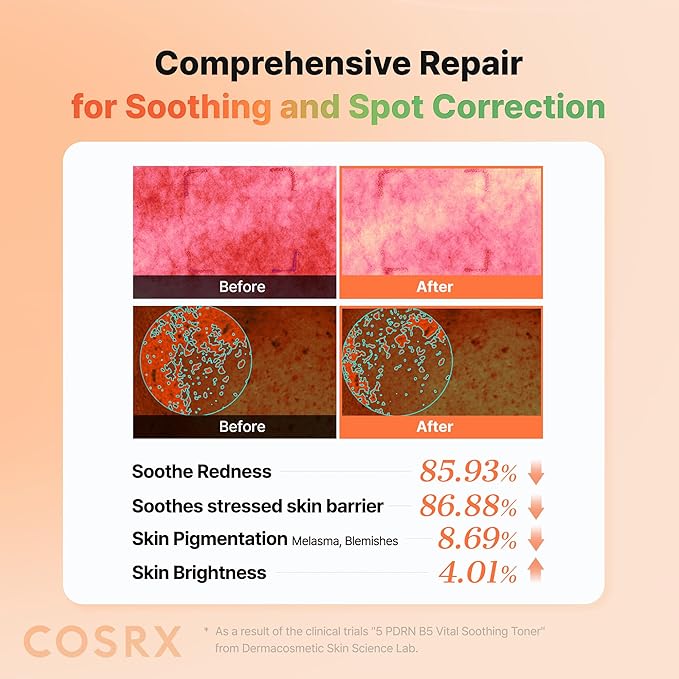 COSRX 5 PDRN B5 Vital Soothing Toner - Korean Toner for Rejuvenating & Soothing Skin with Salmon DNA, Centella, Lactobacillus PDRN & Panthenol, Korean Skin Care, Stocking Stuffers (280ml/9.46 fl.oz.)