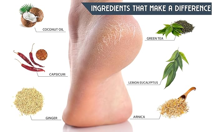 Naturulz Total Foot Repair Bundle & Save – 3oz No Junk Callus Remover Roll On & 4oz Topical Foot Cream for Dry Cracked Heels & Feet, Moisturizer for Feet, Knees, Elbows & Hands, Repairs Cracked Skin