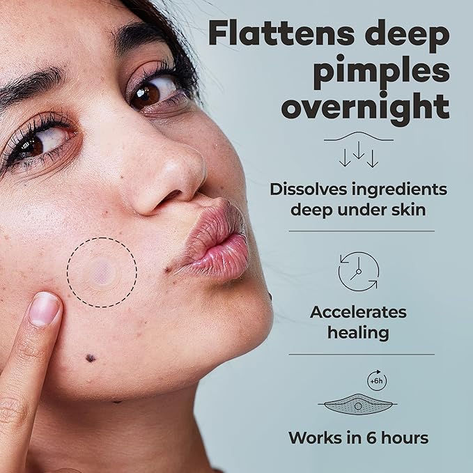 OMMA 72 Patches Pimple Patches for Face and 18 Micropoint Acne Patch Bundle