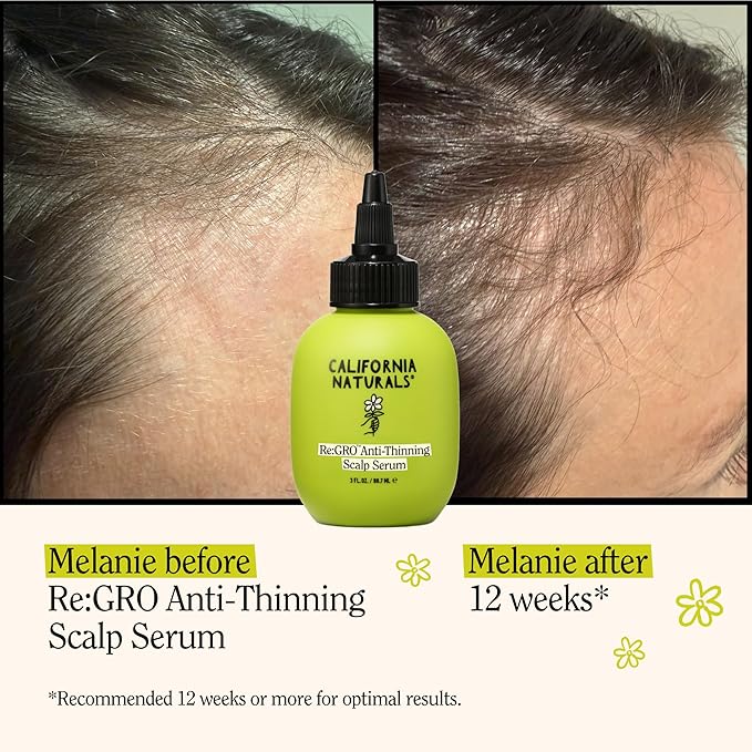 California Naturals Women's Re: Gro Anti-Thinning Scalp Serum, 5% Capixyl with Biotin, Caffeine & Castor and Rosemary Oil, Non-Sticky Cooling Formula, Vegan & Cruelty Free, 3oz