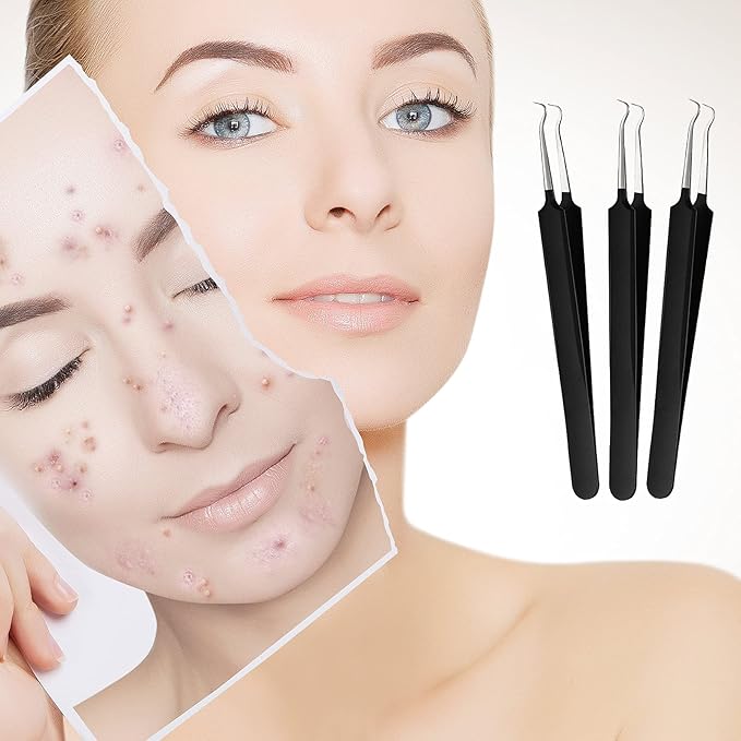 Honoson 3 Pcs Blackhead Tweezer Stainless Steel Pimple Tweezers Extractor Tool for Remove Zit Whitehead Pimple Bend Curved Tweezer Skin Blackhead Remover Tools(Black)