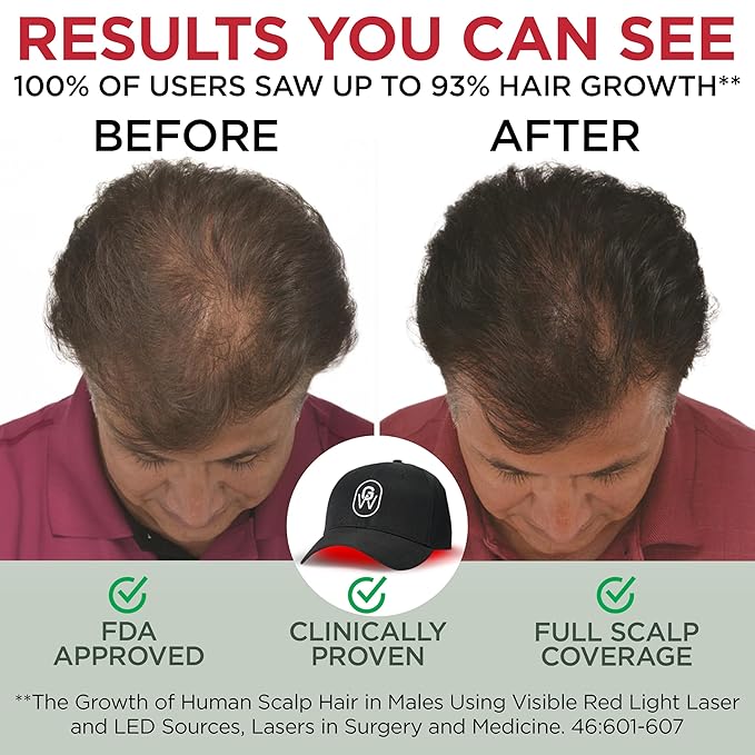 Red Light Therapy Hair Growth Cap – FDA Cleared Laser Treatment for Hair Regrowth and Reduced Shedding – LED & Laser Red Light Therapy Clinically Proven in Double-Blind Studies -Black