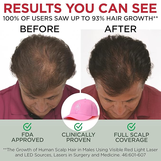 Red Light Therapy Hair Growth Cap – FDA Cleared Laser Treatment for Hair Regrowth and Reduced Shedding – LED & Laser Red Light Therapy Clinically Proven in Double-Blind Studies - Pink