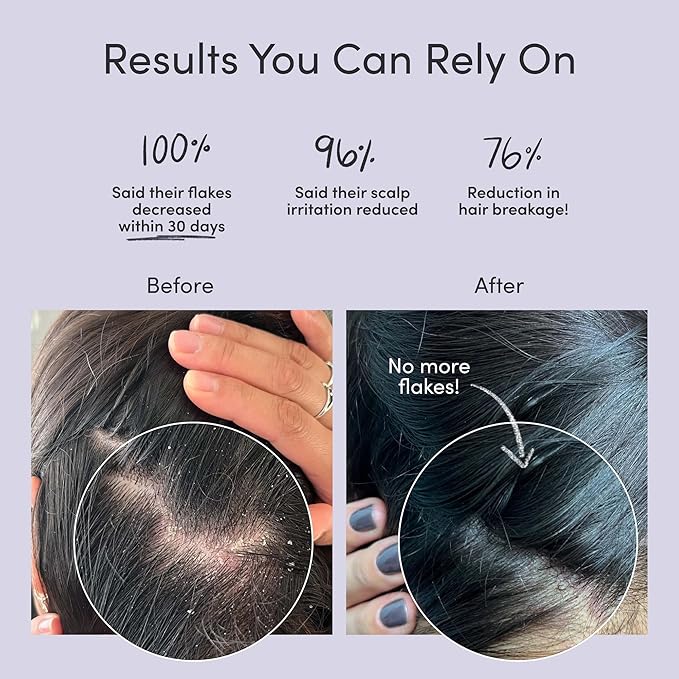 Jupiter Oil Control & Exfoliation Bundle, Anti-Dandruff Shampoo, Conditioner, Restoring Serum, & Purifying Mask for Women & Men, Dermatologist-Formulated for Flaky, Itchy, Oily, & Dry Scalp