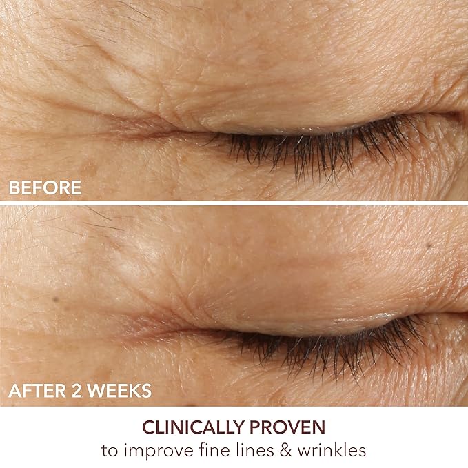 Dr. Dennis Gross Advanced Retinol + Ferulic Eye Serum – Target Dark Circles, Puffiness, Fine Lines & Wrinkles for Smooth, Youthful-Looking Eyes, 0.5 oz