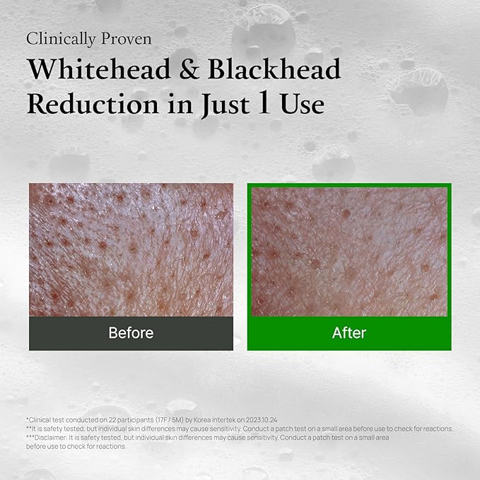 FULLY Green Tomato Pore Detox Clay Mask Cleanser, Pore Minimizing, Blackhead Care, Sebum Control, Exfoliation, Vegan, Face Wash, Sensitive Skin, Korean Skincare 4.05 fl.oz