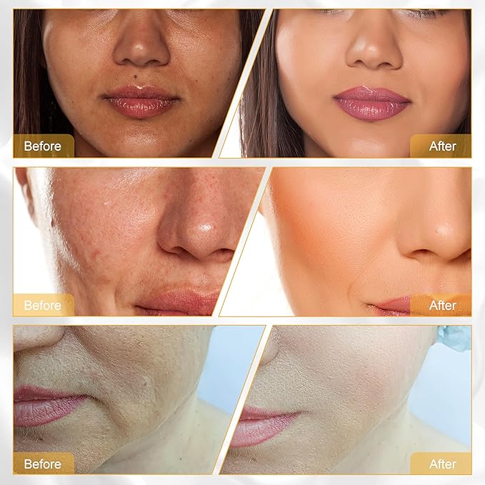 Elitzia CO₂ Oxygen Bubble Facial Device with 7-Color LED - Portable Oxygenating Bubble Skin Care Device for Hydration & Pore Care, Rechargeable Home Spa System - ETOB01