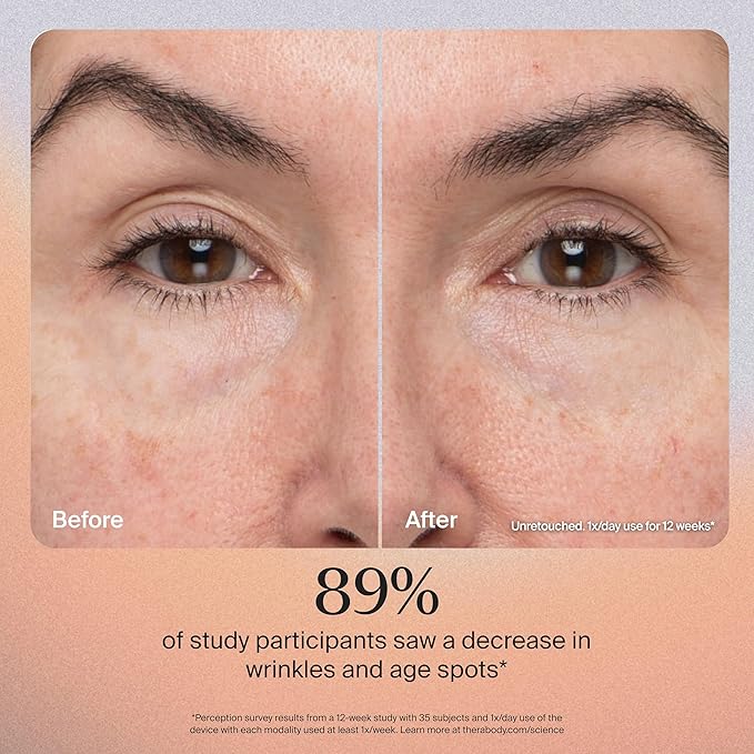 TheraFace Therabody TheraFace PRO - Microcurrent Facial Device, 8-in-1 Compact Face Massager&Facial Sculpting Tool with Light Therapy for Skin Tightening, Anti Wrinkle, Anti Aging & Skin Care (Black)