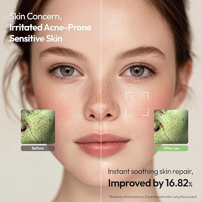 FreeGo Calm Heartleaf Daily Soothing Pad (100 Pads), K-Beauty Facial Toner Pads for Sensitive or Acne-Prone Skin, Instant Soothing Skin Repair