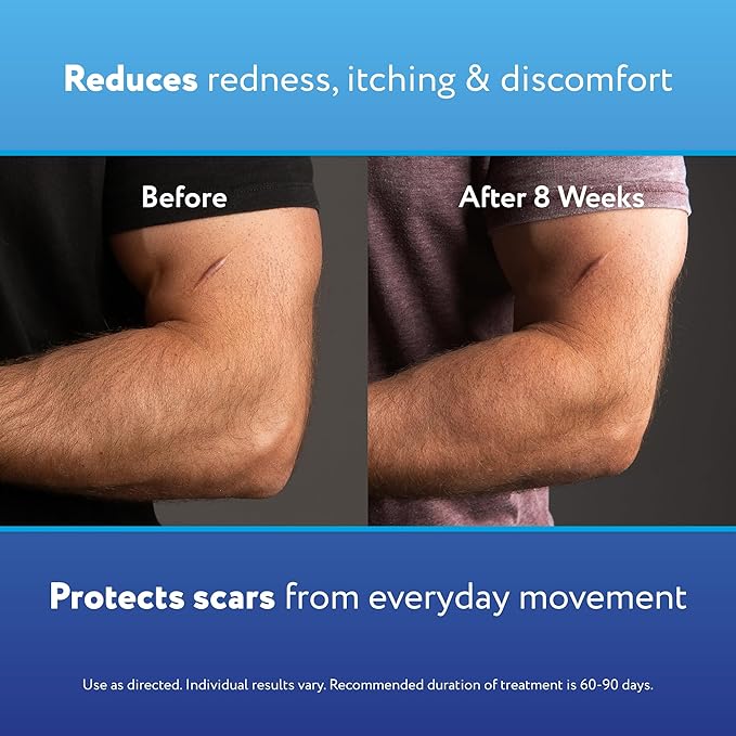 ScarAway Advanced Skincare Silicone Scar Sheets,