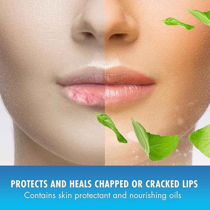 Natural Ice Original SPF 15 Medicated Lip Balm - 12 Count Pack