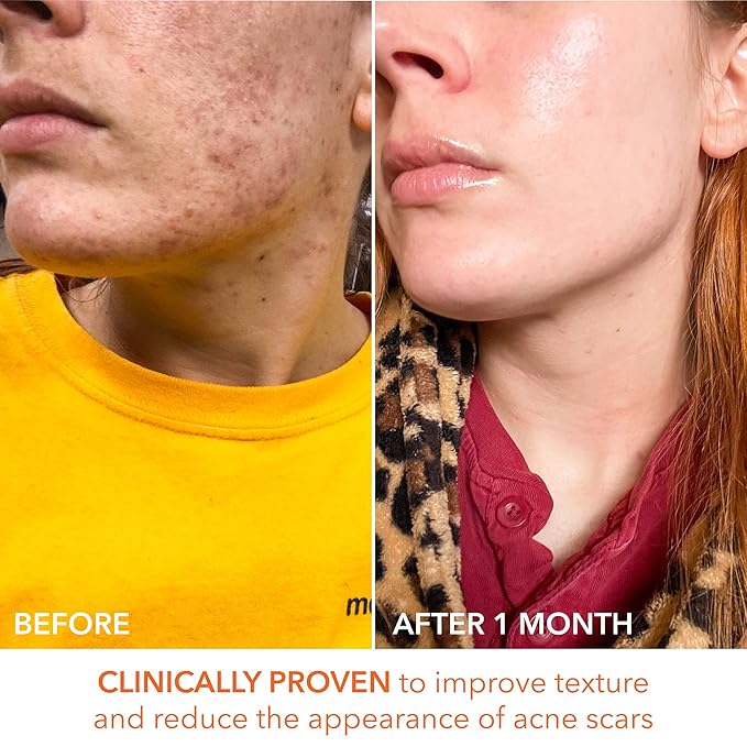 Dr. Dennis Gross Alpha Beta Universal Daily Peel 60 Treatments