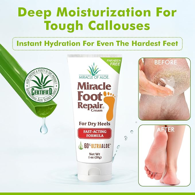 Miracle Foot Repair Cream (1 oz / 12 Pack) Repairs Dry Cracked Heels and Feet, 60% Pure Ultra Aloe Moisturizes, Softens, and Repairs