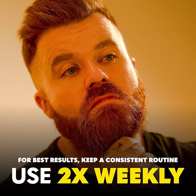 Beard Club Premium Derma Roller & Beard Growth Oil - Microneedling Roller with 540 Titanium Microneedles for Face, Body and Scalp - Beard Roller with Sandalwood & Cedar Beard Oil