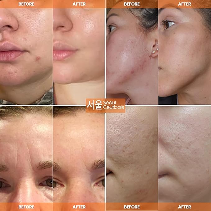 SeoulCeuticals Snail Mucin Moisturizer 97.5% - Korean Skin Care Snail Repair Cream - Day & Night Anti Aging K Beauty Skincare Cruelty Free 2oz