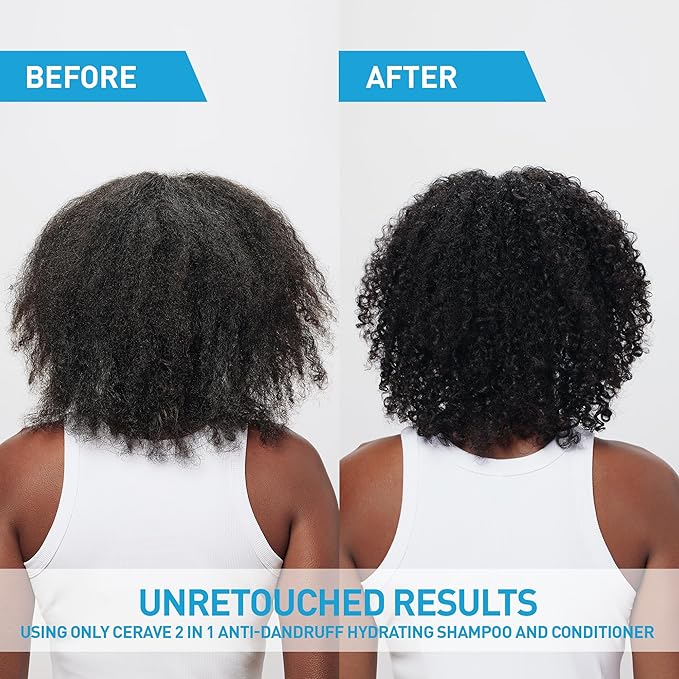 CeraVe 2 In 1 Hydrating Anti Dandruff Shampoo And Conditioner, 1% Pyrithione Zinc Dandruff Treatment, Color Safe & Sulfate Free Shampoo And Conditioner, Helps Eliminate Dandruff & Relieve Itchy Scalp