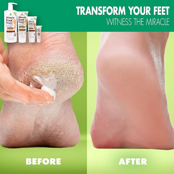 Miracle Foot Repair Cream, (1 oz / 3 Pack) Repairs Dry Cracked Heels and Feet, 60% Pure UltraAloe Moisturizes, Softens, and Repairs