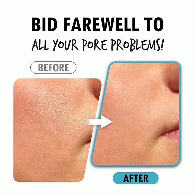 Pore Refining Serum | Pore Minimizing Serum for Face | Organic Face Moisturizer Pore Tightening Serum | Hydrating Face Serum Pore Minimizer Korean Skin Care Products (1.01 Fl. Oz)