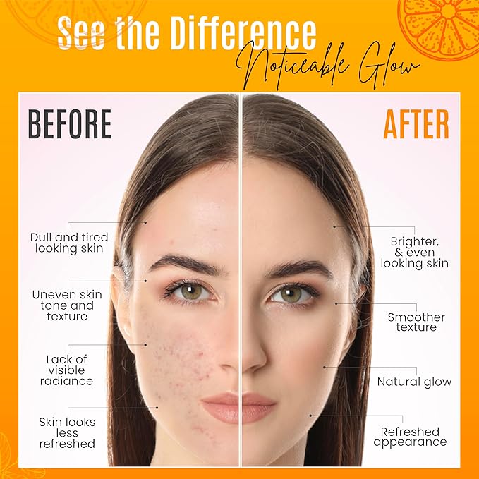 30% Vitamin C Serum for Face - Natural & Organic Anti Wrinkle & Skin Rejuvenator Moisturizer with Hyaluronic Acid & Vitamin E - Powerful Anti Aging Serum - Age-Defying Beauty Regimen- 1FL OZ