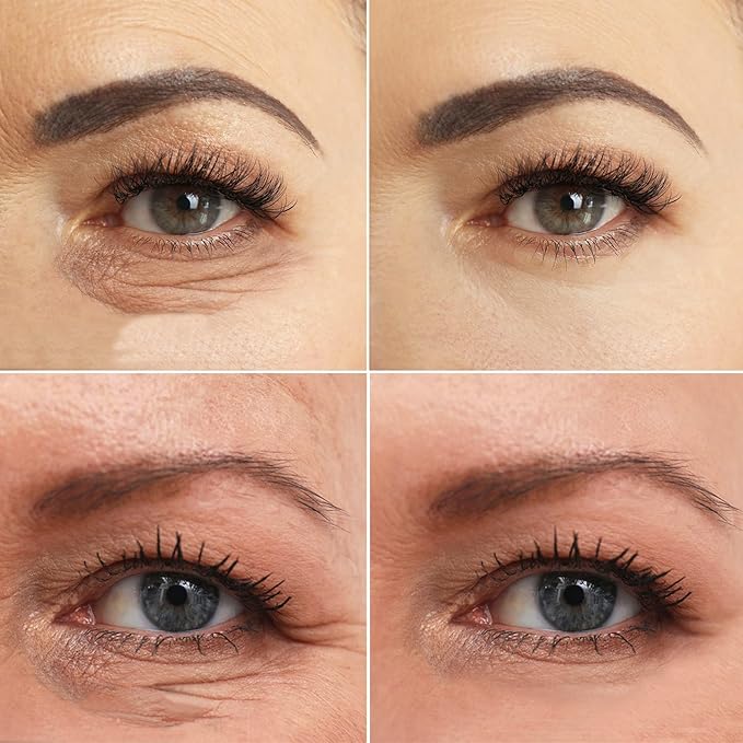 Pdo Lifting Thread, Pdo Threads Lift for Eyes, Helps Restore Skin's Firmness and Elasticity, and Improves Eye Wrinkles (20PCS-30G*25MM)