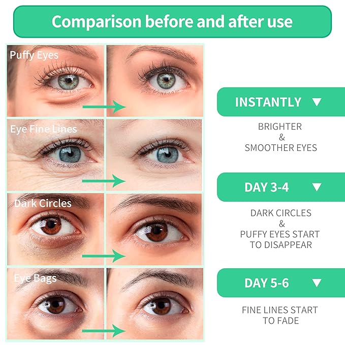 Breylee aloe vera eye masks